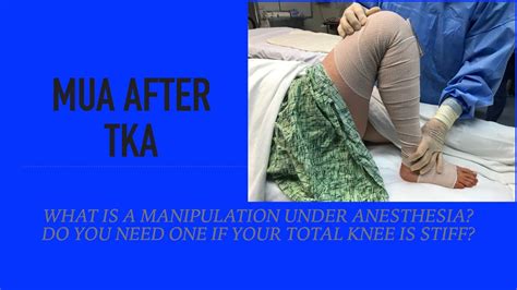 9 dic 2022. . Right knee manipulation under anesthesia cpt code